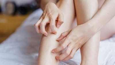 Kulit Gatal Bisa Jadi Pertanda Kita Menderita Penyakit Tertentu 